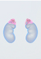 Menopause